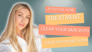 Read more about the article Effective Acne Treatment: Clear Your Skin with These Proven Methods