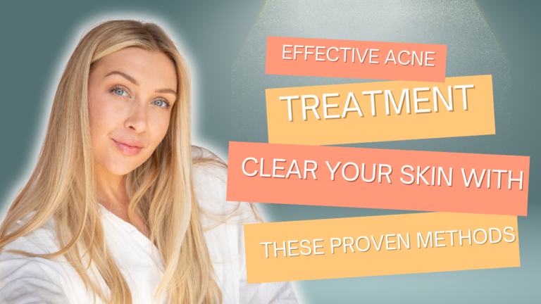 Effective Acne Treatment: Clear Your Skin with These Proven Methods